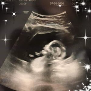 Meet your Posher, Aldon